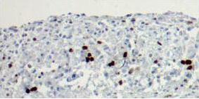 HumanTissue-4